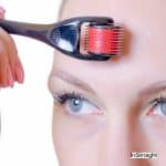 dermarolling on lady's forehead